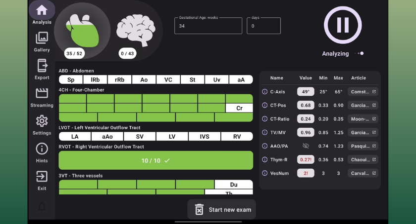 GE HealthCare, Diagnoly Team Up to Advance AI-Enabled Fetal Ultrasound